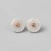 1-Hole Shank Buttons BUTT-WH20002-30B-1